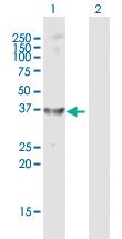 Anti-AKR1C4 Rabbit Polyclonal Antibody