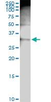 Anti-PRKRA Rabbit Polyclonal Antibody