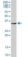 Anti-AKR1C4 Rabbit Polyclonal Antibody