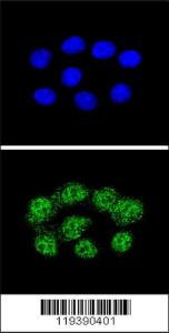 Anti-MSH2 Rabbit Polyclonal Antibody (FITC (Fluorescein Isothiocyanate))