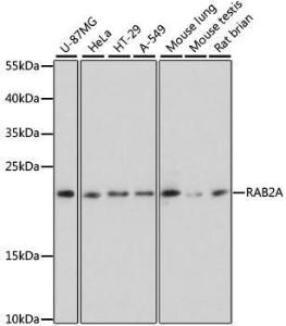 Western blot analysis of extracts of various cell lines, using Anti-Rab2 Antibody (A307092) at 1:3,000 dilution