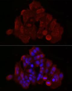 Immunofluorescence analysis of MCF7 cells using Anti-Bax Antibody (A12539) at a dilution of 1:50 (40X lens). DAPI was used to stain the cell nuclei (blue)