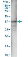 Anti-AKR1C4 Rabbit Polyclonal Antibody