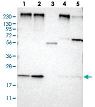 Anti-MPDU1 Rabbit Polyclonal Antibody