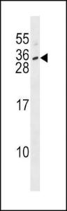 Anti-IFNL3 Rabbit Polyclonal Antibody (FITC (Fluorescein Isothiocyanate))