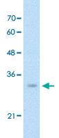 Anti-DCXR Rabbit Polyclonal Antibody