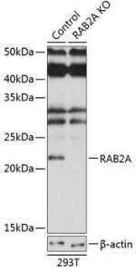 Western blot analysis of extracts from normal (control) and RAB2A knockout (KO) 293T cells, using Anti-Rab2 Antibody (A307093) at 1:3,000 dilution. The secondary Antibody was Goat Anti-Rabbit IgG H&L Antibody (HRP) at 1:10000 dilution