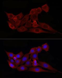 Immunofluorescence analysis of NIH/3T3 cells using Anti-Bax Antibody (A12539) at a dilution of 1:50 (40X lens). DAPI was used to stain the cell nuclei (blue)