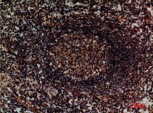 Immunohistochemical analysis of paraffin-embedded human lymph using Anti-ITGA4 Antibody