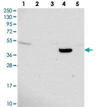 Anti-TMEM44 Rabbit Polyclonal Antibody