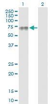 Anti-PLA2G3 Rabbit Polyclonal Antibody