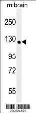 Anti-NTRK1 Mouse Monoclonal Antibody [clone: 185CT47.6.1]