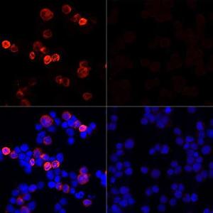 Immunofluorescence analysis of 293T cells transfected with SARS-CoV-2 Spike protein and untreated 293T cells using Anti-SARS-CoV-2 Spike Glycoprotein Antibody (A308165) at a dilution of 1:100 (40x lens). DAPI was used to stain the cell nuclei (blue).