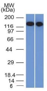 Anti-CD22 antibody