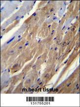 Anti-FGF16 Rabbit Polyclonal Antibody (Biotin)