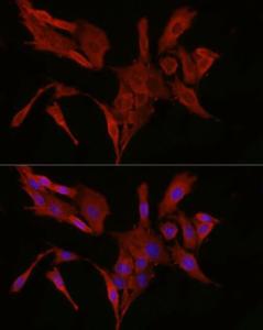 Immunofluorescence analysis of PC-12 cells using Anti-Bax Antibody (A12539) at a dilution of 1:50 (40X lens). DAPI was used to stain the cell nuclei (blue)