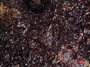 Immunohistochemical analysis of paraffin-embedded human lymph using Anti-ITGA4 Antibody