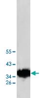 Anti-AKR1C3 Rabbit Polyclonal Antibody