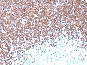 Antibody anti-TDT TDT1393 100 µg