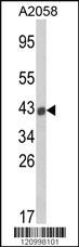 Anti-HLA-B Rabbit Polyclonal Antibody