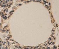 Anti-AKR1C3 Rabbit Polyclonal Antibody