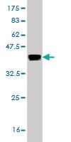 Anti-CRYM Mouse Monoclonal Antibody [clone: 6B3]