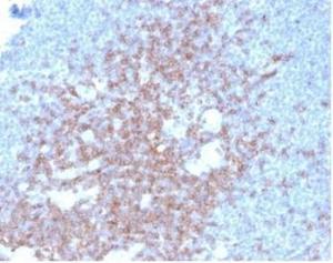 Immunohistochemical analysis of formalin-fixed, paraffin-embedded human lymph node using Anti-CD2 Antibody [LFA2/7102] at 2 µg/ml in PBS for 30 minutes at room temperature