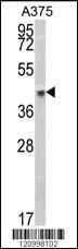 Anti-HLA-B Rabbit Polyclonal Antibody