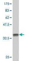 Anti-TSPY1 Mouse Polyclonal Antibody