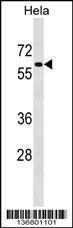 Anti-PAF1 Rabbit Polyclonal Antibody (Biotin)