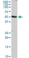 Anti-PLA2G3 Rabbit Polyclonal Antibody