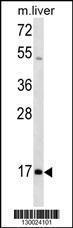 Anti-HOXA1 Rabbit Polyclonal Antibody (AP (Alkaline Phosphatase))