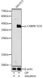 Western blot analysis of extracts of NIH/3T3, using Anti-CEBP Beta (phospho Thr235) Antibody (A308166) at 1:1,000 dilutio