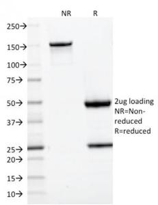 Anti-CD22 antibody