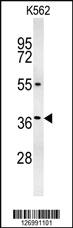 Anti-GCG Rabbit Polyclonal Antibody