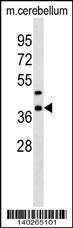 Anti-CRKL Rabbit Polyclonal Antibody (PE (Phycoerythrin))