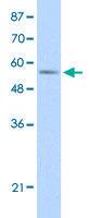 Anti-DDX47 Rabbit Polyclonal Antibody