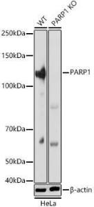 Western blot analysis of extracts from wild type(WT) and PARP1 knockout (KO) HeLa cells, using Anti-PARP1 Antibody (A308167) at 1:5,000 dilution. The secondary antibody was Goat Anti-Rabbit IgG H&L Antibody (HRP) at 1:10,000 dilution.