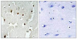 Immunohistochemical analysis of paraffin-embedded human brain tissue using Anti-TREF1 Antibody. The right hand panel represents a negative control, where the antibody was pre-incubated with the immunising peptide