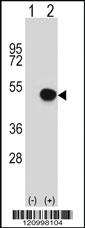 Anti-HLA-B Rabbit Polyclonal Antibody