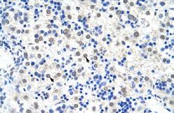 Anti-DDX47 Rabbit Polyclonal Antibody