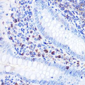 Immunohistochemistry analysis of paraffin-embedded human appendix tissue using Anti-Bcl-2 Antibody (A12540) at a dilution of 1:100 (40x lens). Perform microwave antigen retrieval with 10 mM PBS buffer pH 7.2 before commencing with IHC staining protocol