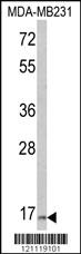 Anti-CSTA Rabbit Polyclonal Antibody