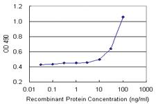 Anti-MCC Polyclonal Antibody Pair