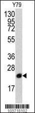 Anti-Prostatic Binding Protein Rabbit Polyclonal Antibody