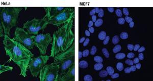 Anti-Caldesmon-1 Rabbit Monoclonal Antibody [clone: 13G23]