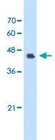 Anti-DFNA5 Rabbit Polyclonal Antibody