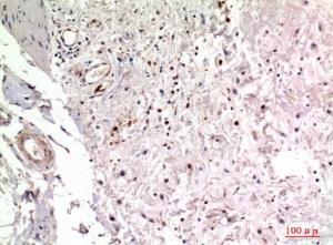 Immunohistochemical analysis of paraffin-embedded human colon using Anti-ITGA2 Antibody