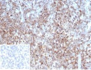 Immunohistochemical analysis of formalin-fixed, paraffin-embedded human tonsil tissue using Anti-CD2 Antibody [LFA2/7102]. Inset: PBS instead of the primary antibody. Secondary antibody negative control