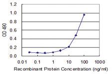 Anti-COASY Polyclonal Antibody Pair